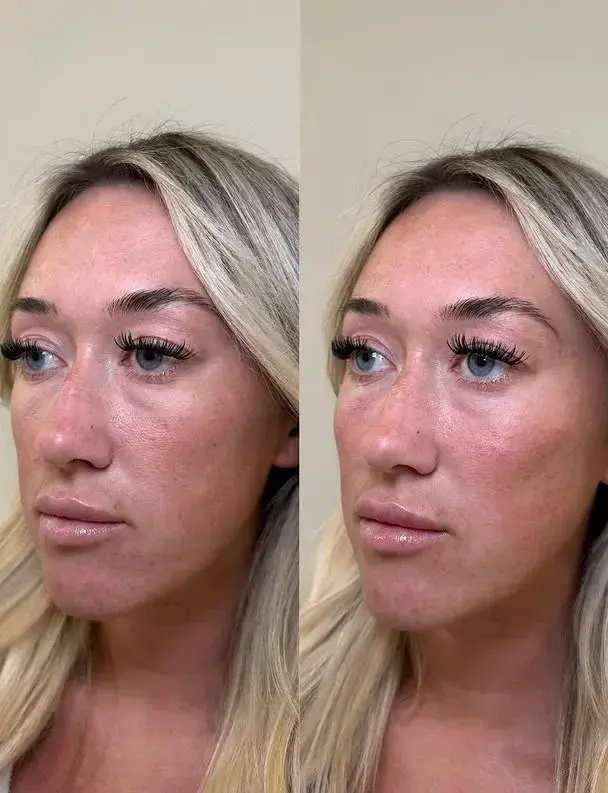 Face Insta feed - Shop - at nashvillewellnessiv
