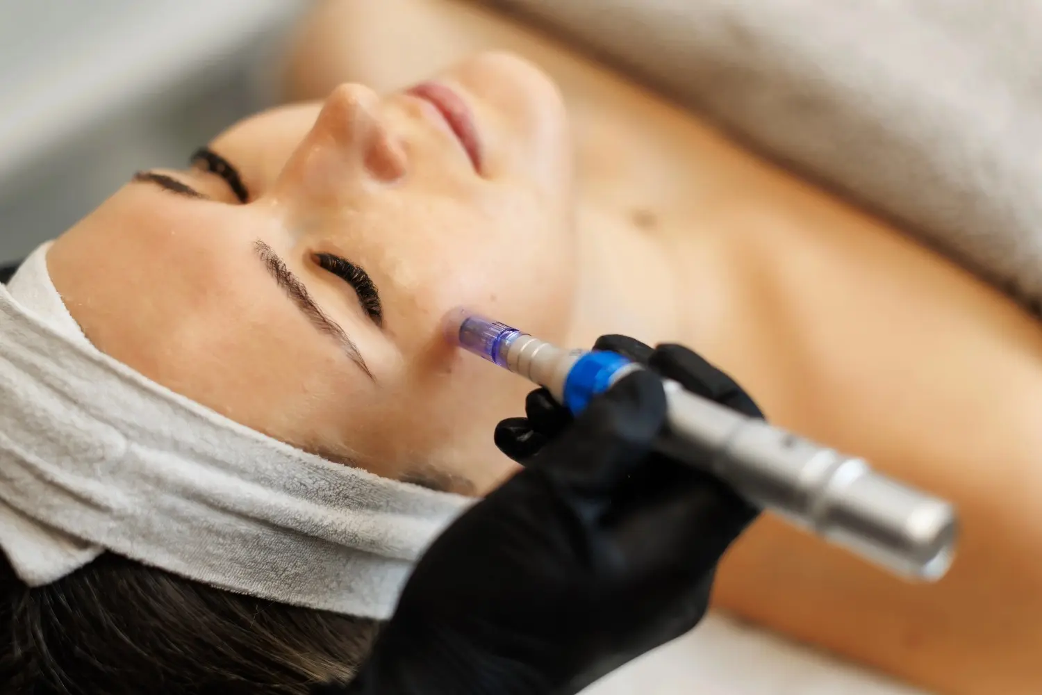 Provider performing Procell microchanneling treatment on a woman's face to stimulate natural collagen production and skin renewal